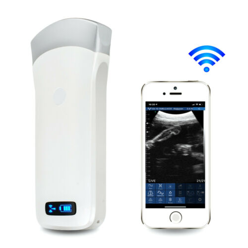Portable WIFI Wireless Ultrasound Scanner Convex/Linear Probe 1 Portable WIFI Wireless Ultrasound Scanner Convex/Linear Probe